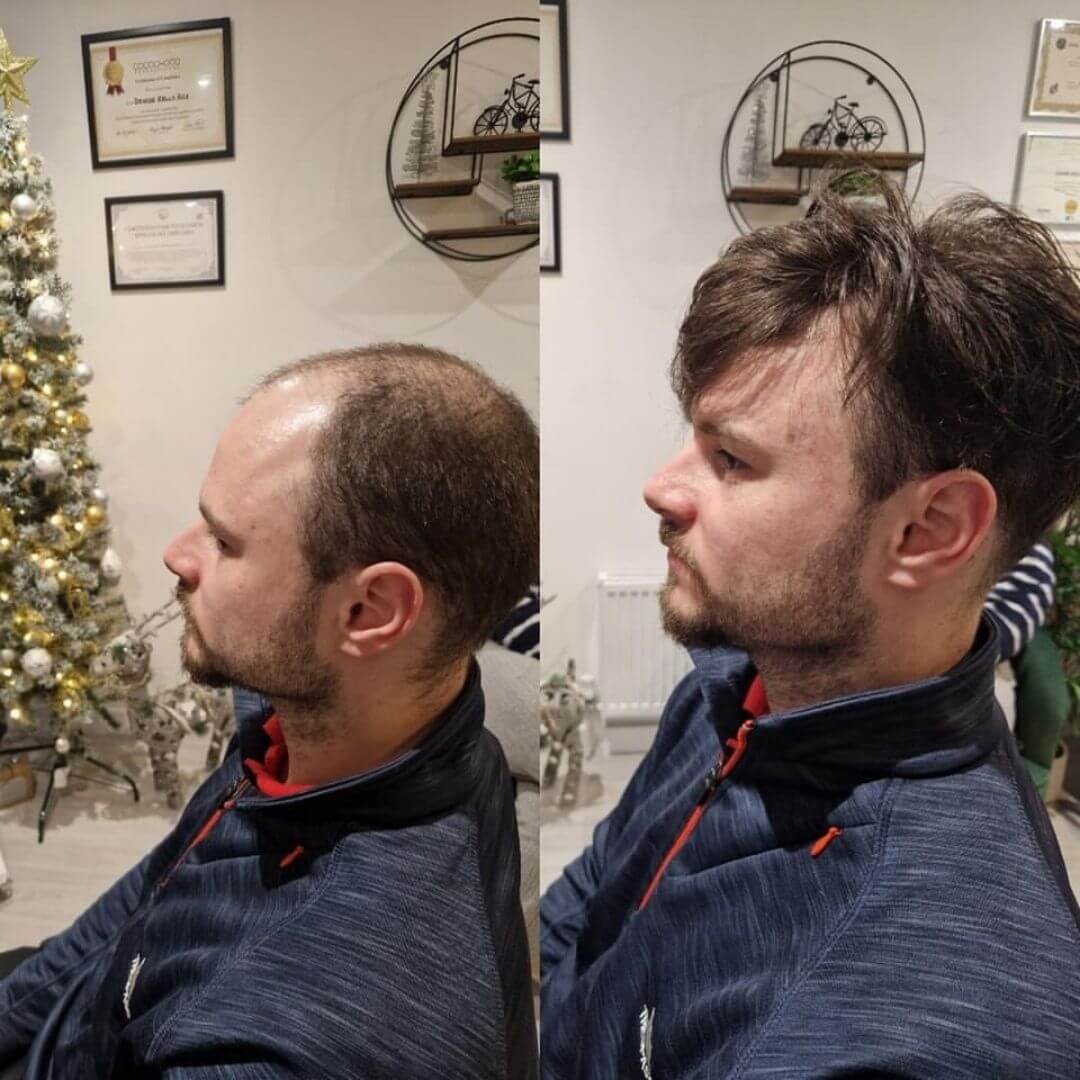 Certified Online Toupee / Men's Hair Replacement Course